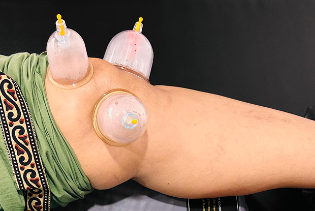 Treatment Image
